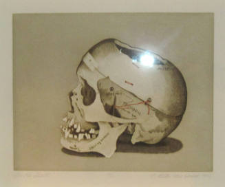 Dr. R's Skull