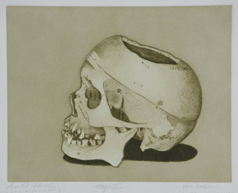 Dr. R's Skull