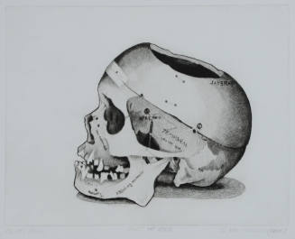 Dr. R's Skull