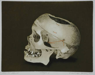 Dr. R's Skull
