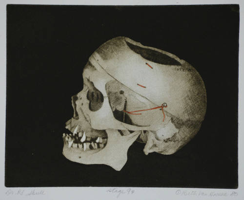 Dr. R's Skull
