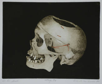 Dr. R's Skull