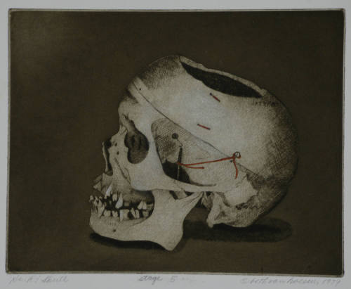 Dr. R's Skull